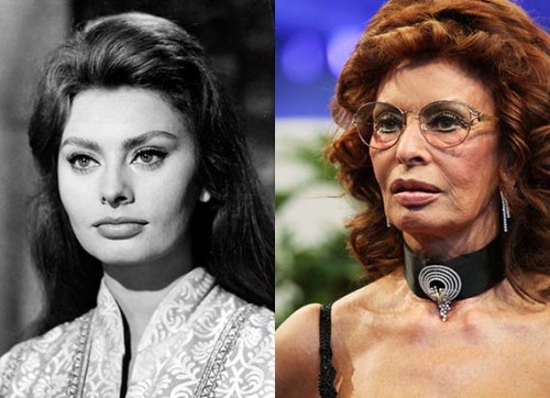 Sophia-Loren-Plastic-Surgery.jpg